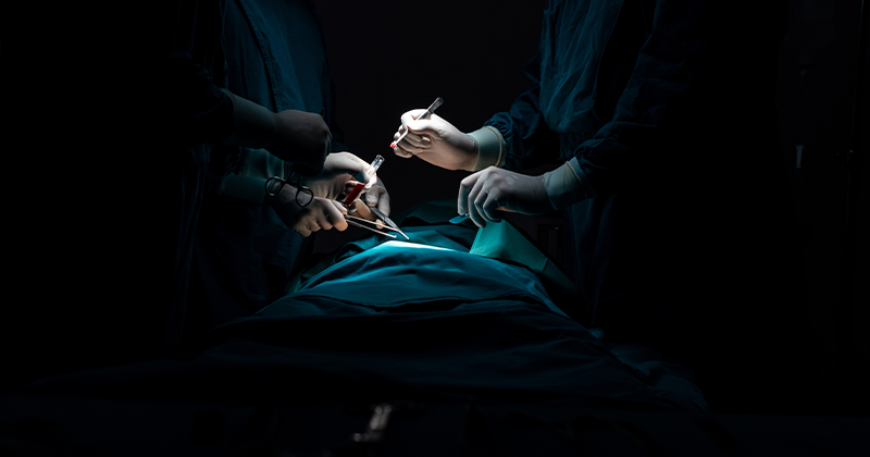 under the knife image 